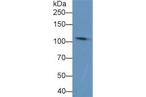 Detection of C5a in Rat Plasma using Polyclonal Antibody to Complement Component 5a (C5a) (C5A antibody  (AA 679-755))