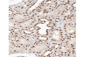 ABIN6267664 at 1/200 staining human kidney tissue sections by IHC-P. (MAPK14 antibody  (pTyr182))