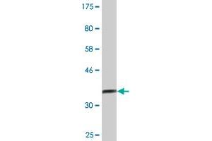 Western Blot detection against Immunogen (37. (ASH2L antibody  (AA 424-530))