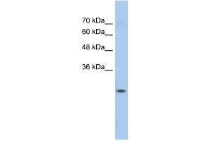 WB Suggested Anti-GSTM1 Antibody Titration:  0.