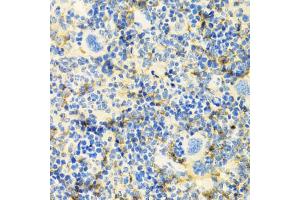 Immunohistochemistry of paraffin-embedded mouse spleen using ICOS antibody (ABIN5970917) at dilution of 1/100 (40x lens). (ICOS antibody)