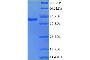 SDS-PAGE (SDS) image for Tescalcin (TESC) (AA 2-214) protein (His-SUMO Tag) (ABIN4975970)