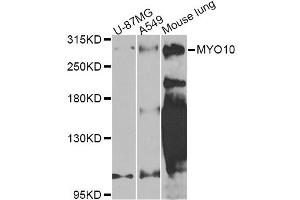 Western blot analysis of extracts of various cell lines, using MYO10 Antibody (ABIN5974593) at 1/1000 dilution. (Myosin X antibody)