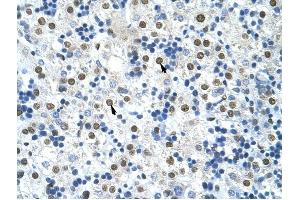 HNRPA0 antibody was used for immunohistochemistry at a concentration of 4-8 ug/ml to stain Hepatocytes (arrows) in Human Liver. (HNRNPA0 antibody  (Middle Region))