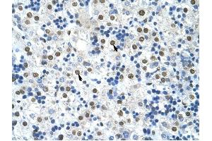 HNRPA0 antibody was used for immunohistochemistry at a concentration of 4-8 ug/ml to stain Hepatocytes (arrows) in Human Liver.