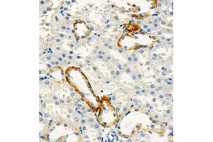 Immunohistochemistry of paraffin embedded mouse kidney using Cdcp1 (ABIN7073600) at dilution of 1:300 (400x lens)