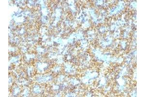 Formalin-fixed, paraffin-embedded human parathyroid stained with PTH antibody (PTH/1174). (PTH antibody  (AA 32-115))