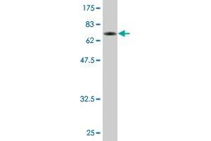 Western Blot detection against Immunogen (73. (TADA3L antibody  (AA 1-432))