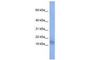 Image no. 1 for anti-Bromodomain and WD Repeat Domain Containing 1 (BRWD1) (N-Term) antibody (ABIN6743057) (BRWD1 antibody  (N-Term))