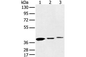 Western blot analysis of 231 cell Human fetal liver and Human fetal brain tissue using MAT2B Polyclonal Antibody at dilution of 1:500 (MAT2B antibody)