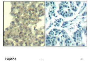 Image no. 1 for anti-Receptor Tyrosine-Protein Kinase ErbB-3 (ERBB3) (AA 1326-1330) antibody (ABIN319383) (ERBB3 antibody  (AA 1326-1330))