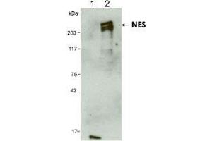 Detection of human NES using NES monoclonal antibody, clone 10C2 . (Nestin antibody  (AA 1464-1614))