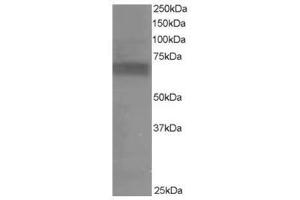 Image no. 1 for anti-Ribosomal Protein S6 Kinase, 70kDa, Polypeptide 1 (RPS6KB1) (C-Term) antibody (ABIN374267) (RPS6KB1 antibody  (C-Term))