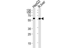 Western Blotting (WB) image for anti-Glucokinase (Hexokinase 4) (GCK) antibody (ABIN2930453) (GCK antibody)