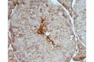 Mouse testis tissue was stained by Rabbit Anti-Desnutrin (465-486) (Mouse) Serum (PNPLA2 antibody  (AA 465-486))