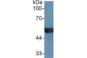 Western Blot; Sample: Mouse Liver lysate; Primary Ab: 1µg/ml Rabbit Anti-Human CYP2D6 Antibody Second Ab: 0. (CYP2D6 antibody  (AA 236-472))