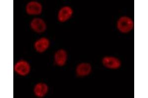 ABIN6275740 staining Hela by IF/ICC. (MNT antibody  (Internal Region))