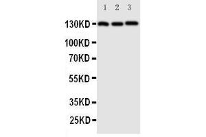 Western Blotting (WB) image for anti-Cadherin 5 (CDH5) (AA 766-784), (C-Term) antibody (ABIN3042913) (Cadherin 5 antibody  (C-Term))