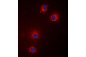 Immunofluorescent analysis of GPR18 staining in Jurkat cells. (GPR18 antibody  (Center))