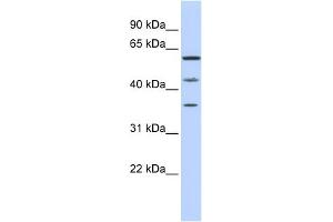 WB Suggested Anti-PHF23 Antibody Titration:  0.