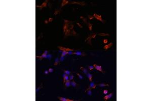 Immunofluorescence analysis of NIH/3T3 cells using  antibody (ABIN6133586, ABIN6137050, ABIN6137052 and ABIN6225252) at dilution of 1:100. (Aquaporin 5 antibody  (AA 150-250))