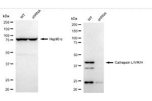 Western blotting analysis using Cathepsin L/V/K/H antibody (ABIN7797941). (Recombinant Cathepsin LVKH antibody)