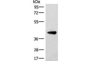 ST8SIA4 anticorps