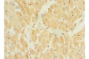 Immunohistochemistry of paraffin-embedded human heart tissue using ABIN7172320 at dilution of 1:100 (TP53TG5 antibody  (AA 1-290))