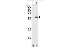 Western blot analysis of STK4 (arrow) using MST1 Antibody (C-term) (ABIN392427 and ABIN2842030). (MST1 antibody  (C-Term))