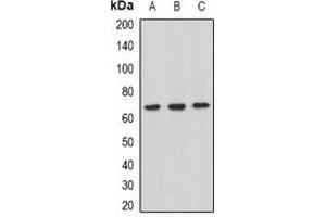 Western blot analysis of XPV expression in Hela (A), HepG2 (B), Raji (C) whole cell lysates. (POLH antibody)