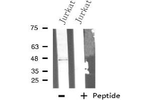 Western blot analysis of extracts from Jurkat cells using PLCH antibody.