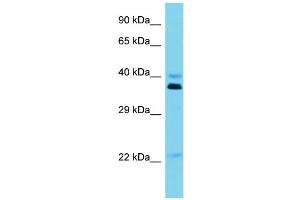 Host: Rabbit Target Name: OR5I1 Sample Type: Jurkat Whole Cell lysates Antibody Dilution: 1.