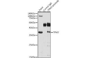 Immunoprecipitation analysis of 300 μg extracts of Mouse skeletal muscle cells using 3 μg TPM2 antibody (ABIN3017364, ABIN3017365, ABIN3017366 and ABIN6220054). (TPM2 antibody)