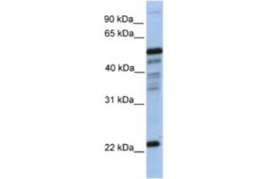 Western Blotting (WB) image for anti-Prostaglandin D2 Synthase (PTGDS) antibody (ABIN2463214) (PTGDS antibody)