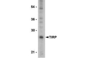 Western blot analysis of TIRP in PC-3 cell lysate with this product at 1 μg/ml. (TICAM2 antibody  (C-Term))