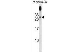 TGIF2 Antibody (C-term) western blot analysis in mouse Neuro-2a cell line lysates (35 µg/lane). (TGIF2 antibody  (C-Term))