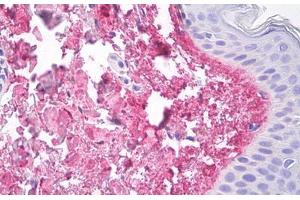 Image no. 2 for anti-Collagen, Type V, alpha 1 (COL5A1) antibody (ABIN1502289)