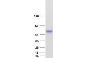 Western Blotting (WB) image for Tubulin Folding Cofactor E-Like (TBCEL) (Transcript Variant 1) protein (Myc-DYKDDDDK Tag) (ABIN2733294)