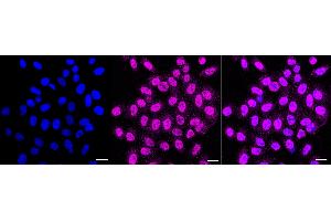 anti-Excision Repair Cross Complementing Polypeptide-1 (ERCC1) antibody