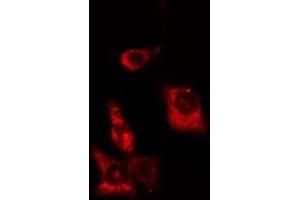 ABIN6276563 staining Hela cells by IF/ICC. (ACTN1 antibody  (N-Term))