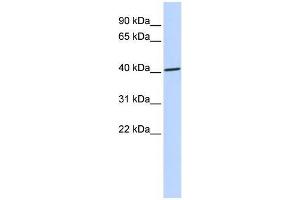 Human 721_B; WB Suggested Anti-ZNF696 Antibody Titration: 0. (ZNF696 antibody  (N-Term))