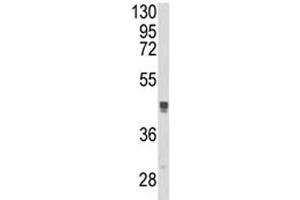 Western blot analysis of TGN46 antibody and MCF-7 lysate. (TGOLN2 antibody  (AA 399-427))