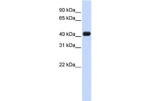WB Suggested Anti-RTCD1 Antibody Titration: 0. (RTCD1 antibody  (N-Term))