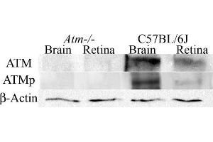 Determination of ATM and ATMp antibodies specificity by western blotting. (ATM antibody  (AA 1974-1988))