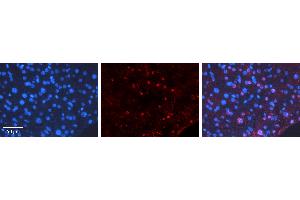 Rabbit Anti-CEBPD Antibody   Formalin Fixed Paraffin Embedded Tissue: Human Liver Tissue Observed Staining: Nucleus Primary Antibody Concentration: 1:100 Other Working Concentrations: N/A Secondary Antibody: Donkey anti-Rabbit-Cy3 Secondary Antibody Concentration: 1:200 Magnification: 20X Exposure Time: 0. (CEBPD antibody  (Middle Region))