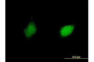 Immunofluorescence of purified MaxPab antibody to RXRG on HeLa cell.