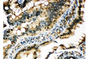 Anti-Egr1 antibody, IHC(P) IHC(P): Rat Intestine Tissue (EGR1 antibody  (N-Term))