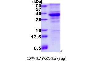 Image no. 1 for Cyclin-Dependent Kinase 5 (CDK5) protein (His tag) (ABIN1098713)