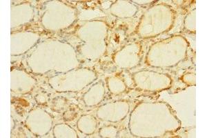 Immunohistochemistry of paraffin-embedded human thyroid tissue using ABIN7174896 at dilution of 1:100