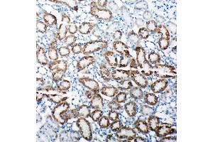 Anti-TRAM1 antibody, IHC(P) IHC(P): Rat Kidney Tissue (TRAM1 antibody  (C-Term))